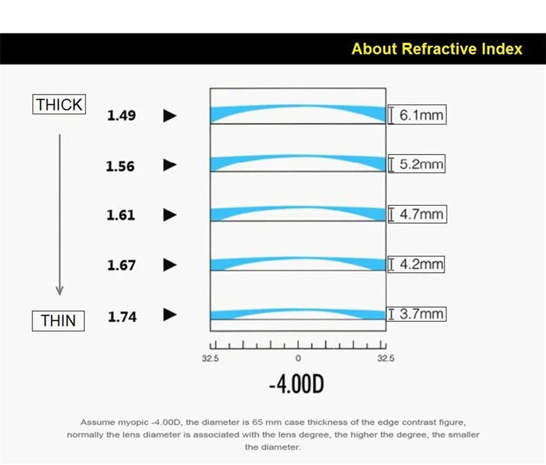 EYELUYAN Prescription Glasses 1.61 MR-8 Anti Radiation Aspheric Lens Myopia Optical Rimless Eyeglasses Pure Titanium Frame